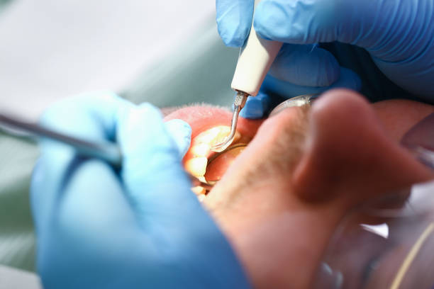 Best Emergency Cosmetic Dentistry in Pleasant Hill, CA