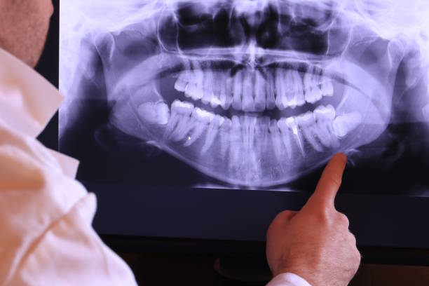 Best Emergency Dentist for Knocked-Out Tooth in Pleasant Hill, CA
