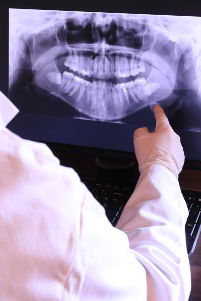 Best Holiday Emergency Dentist in Pleasant Hill, CA