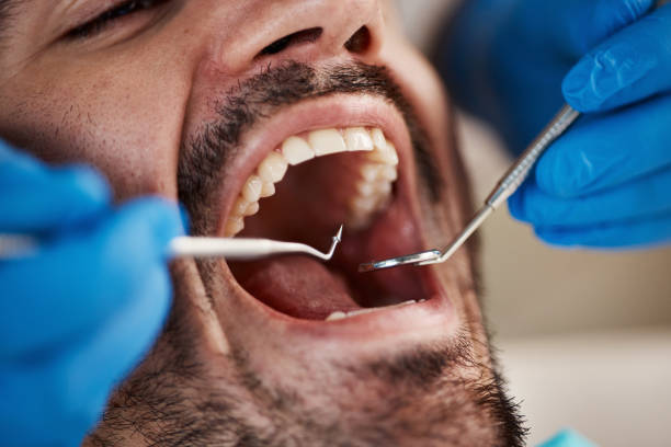 Best Emergency Dentist for Knocked-Out Tooth in Pleasant Hill, CA