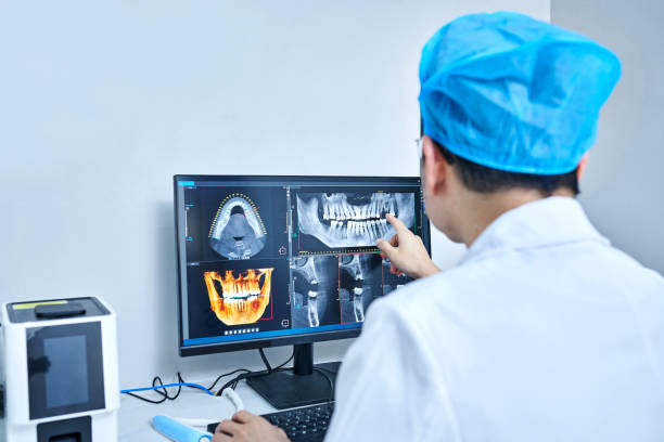 Best Emergency Dental Extractions in Pleasant Hill, CA