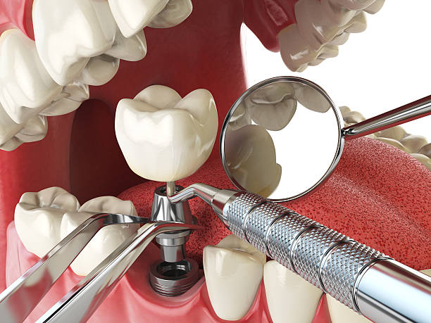 Best Mobile Emergency Dentist in Pleasant Hill, CA